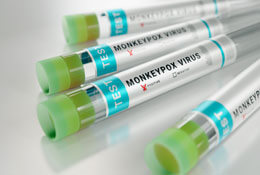 Why Monkeypox is a Growing Concern